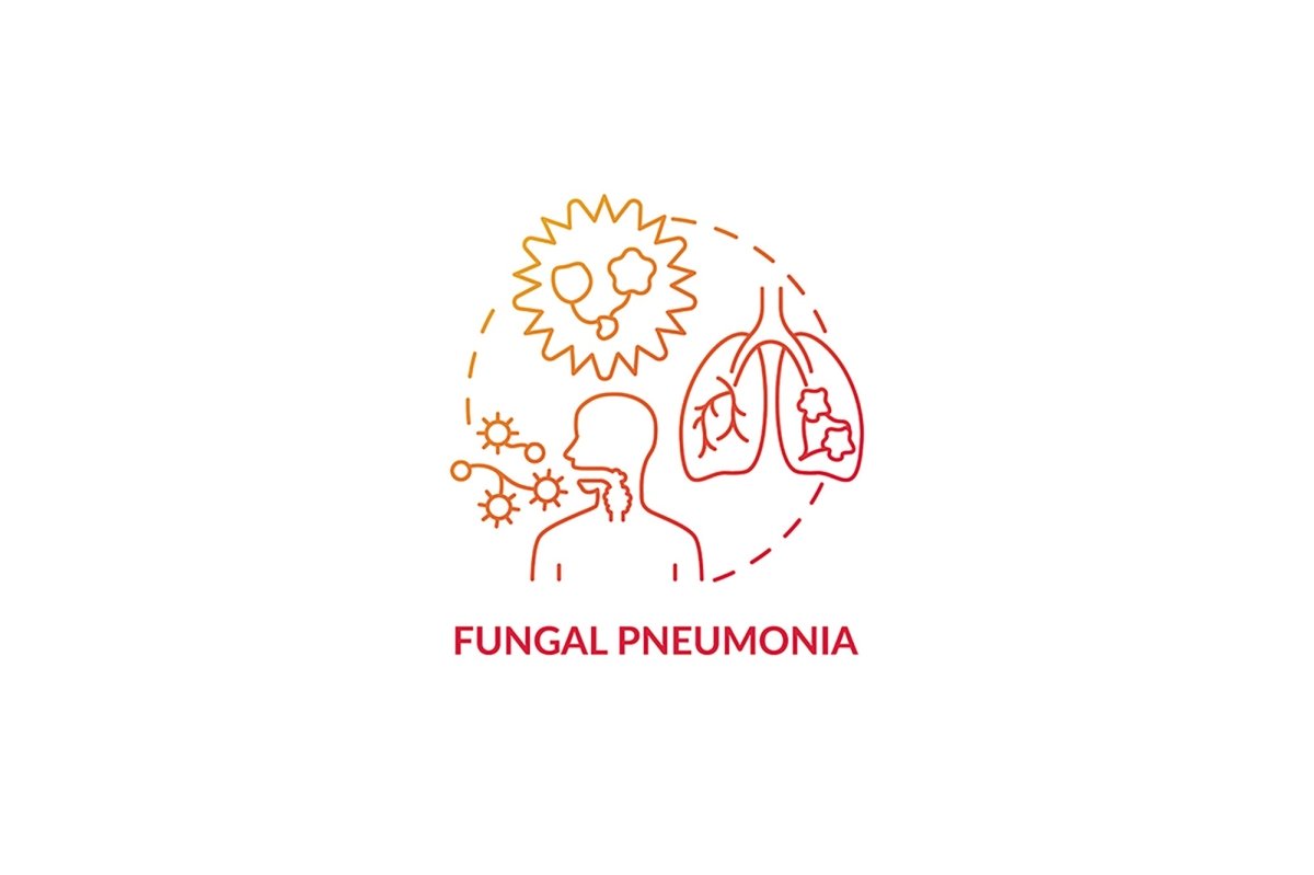 Pneumonia concept icons bundle