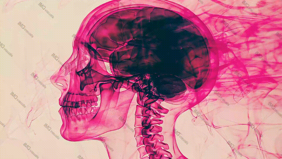 Creative X-ray human skull and brain in pink fog video animation, ai generated