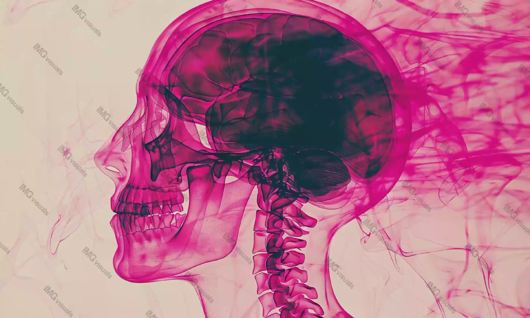 Creative X-ray human skull and brain in pink fog video animation, ai generated. Medical imagery with cyberpunk aesthetics animated footage HD clip seamless motion graphics. Futuristic concept
