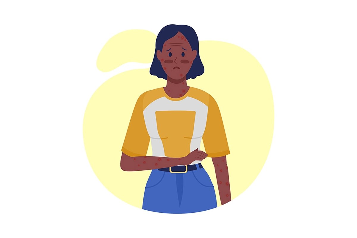 People with virus side effects semi flat color vector character set